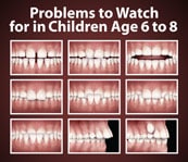 Kids Developing Jaws Teeth