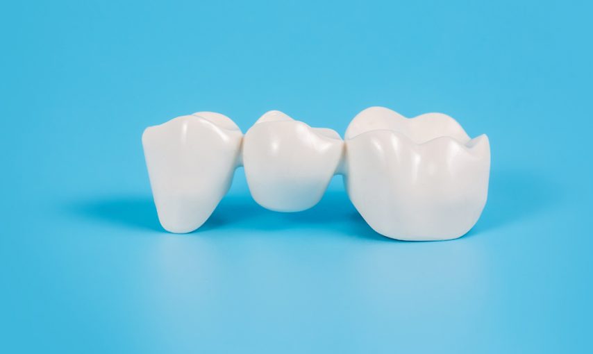 How Do CEREC Crowns Work
