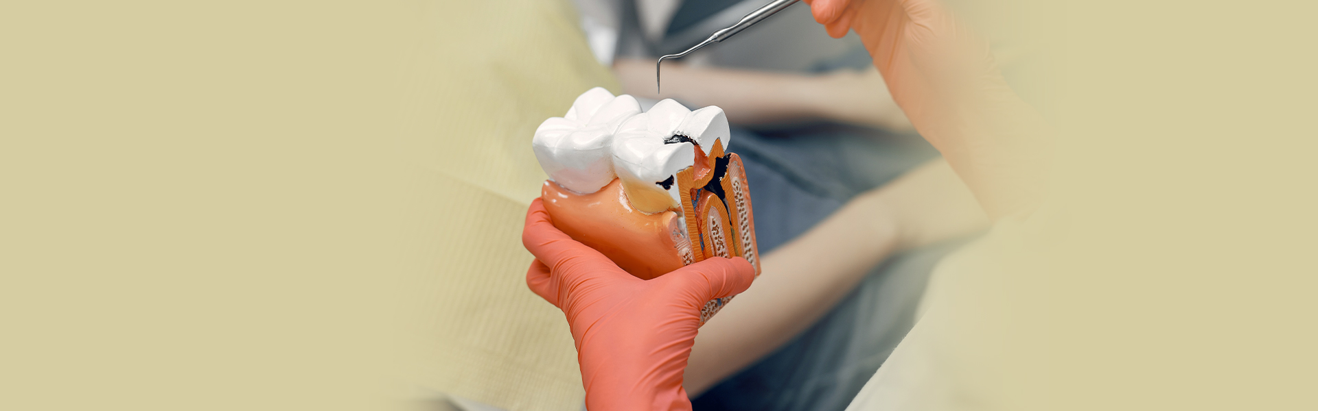 What Materials Are Used to Make Dental Sealants?