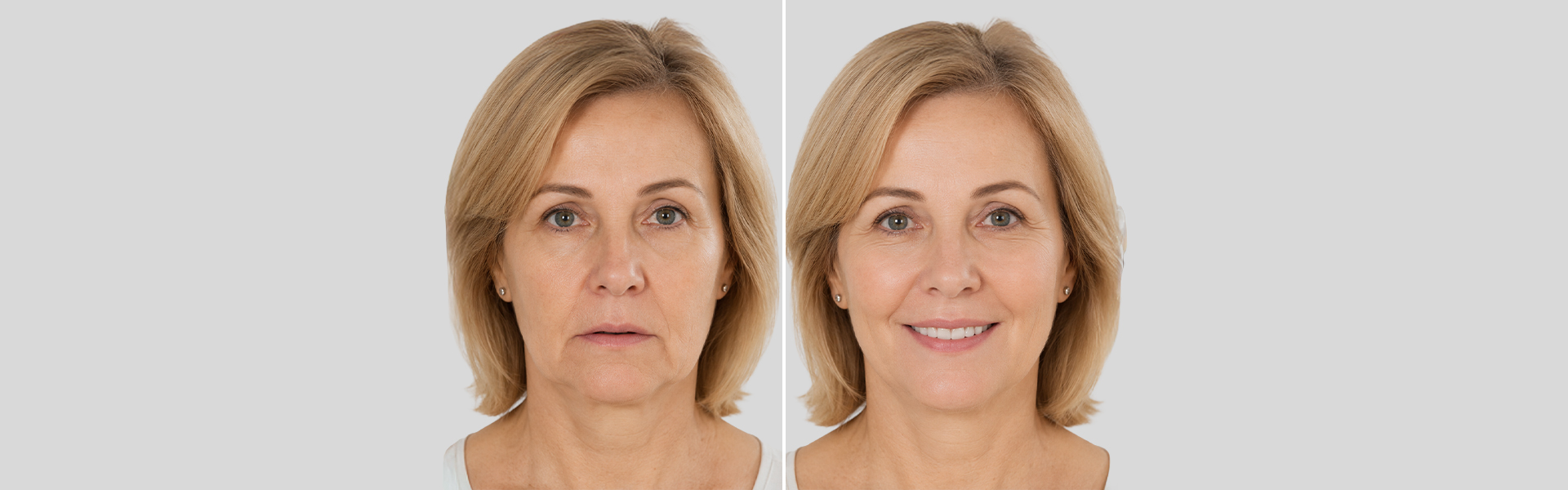 Comparison image